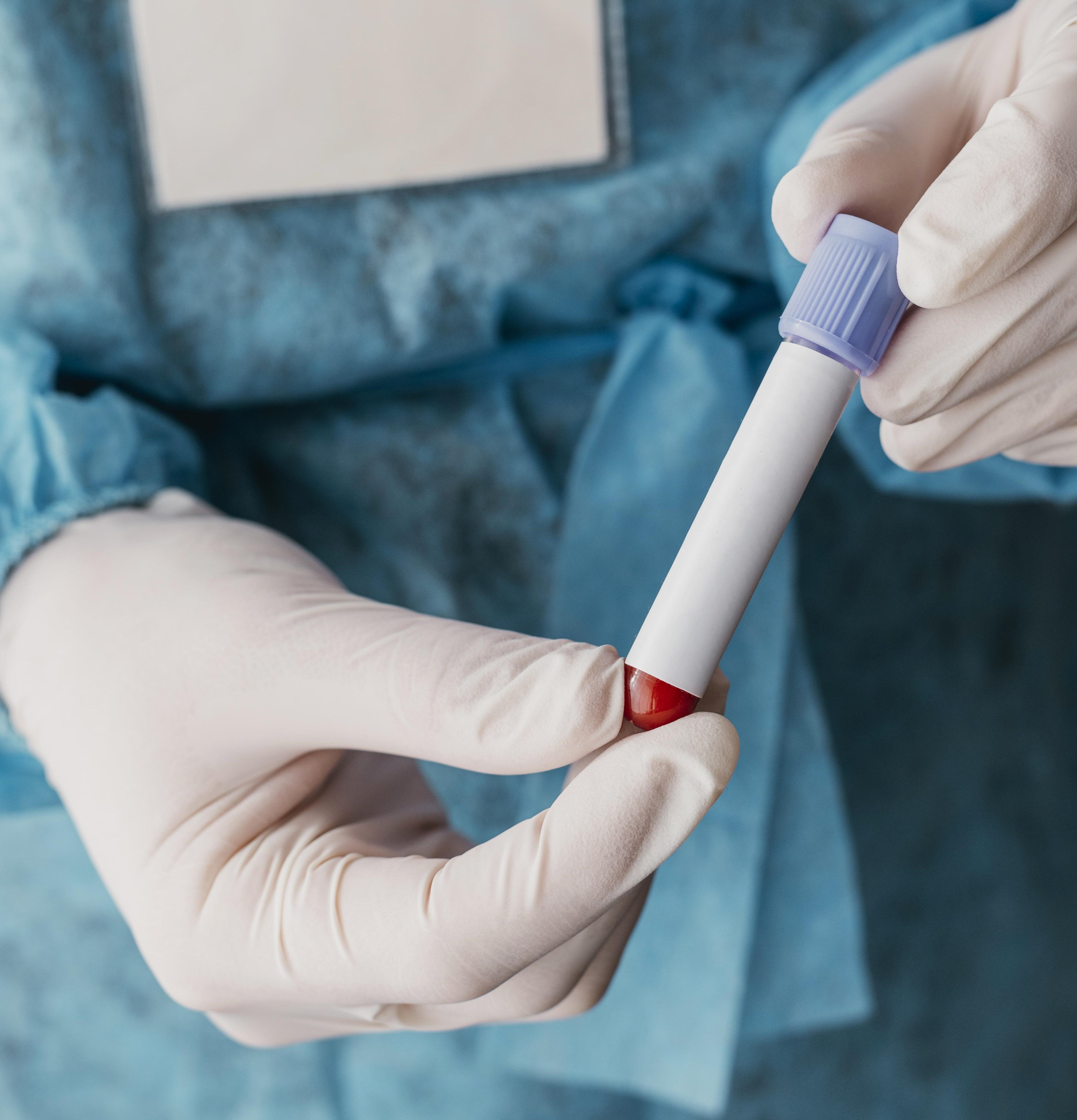 Exame de Sangue Landing Image